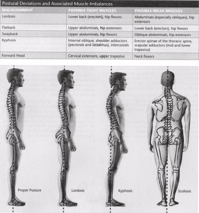 ISSA Unit 6 - Musculoskeletal deviations 9 ISSA Unit 6 - Musculoskeletal deviations 7