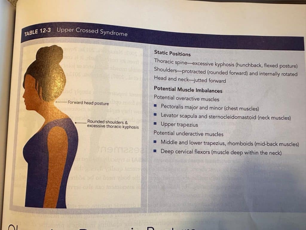 NASM table showing upper crossed syndrome and muscle imbalances